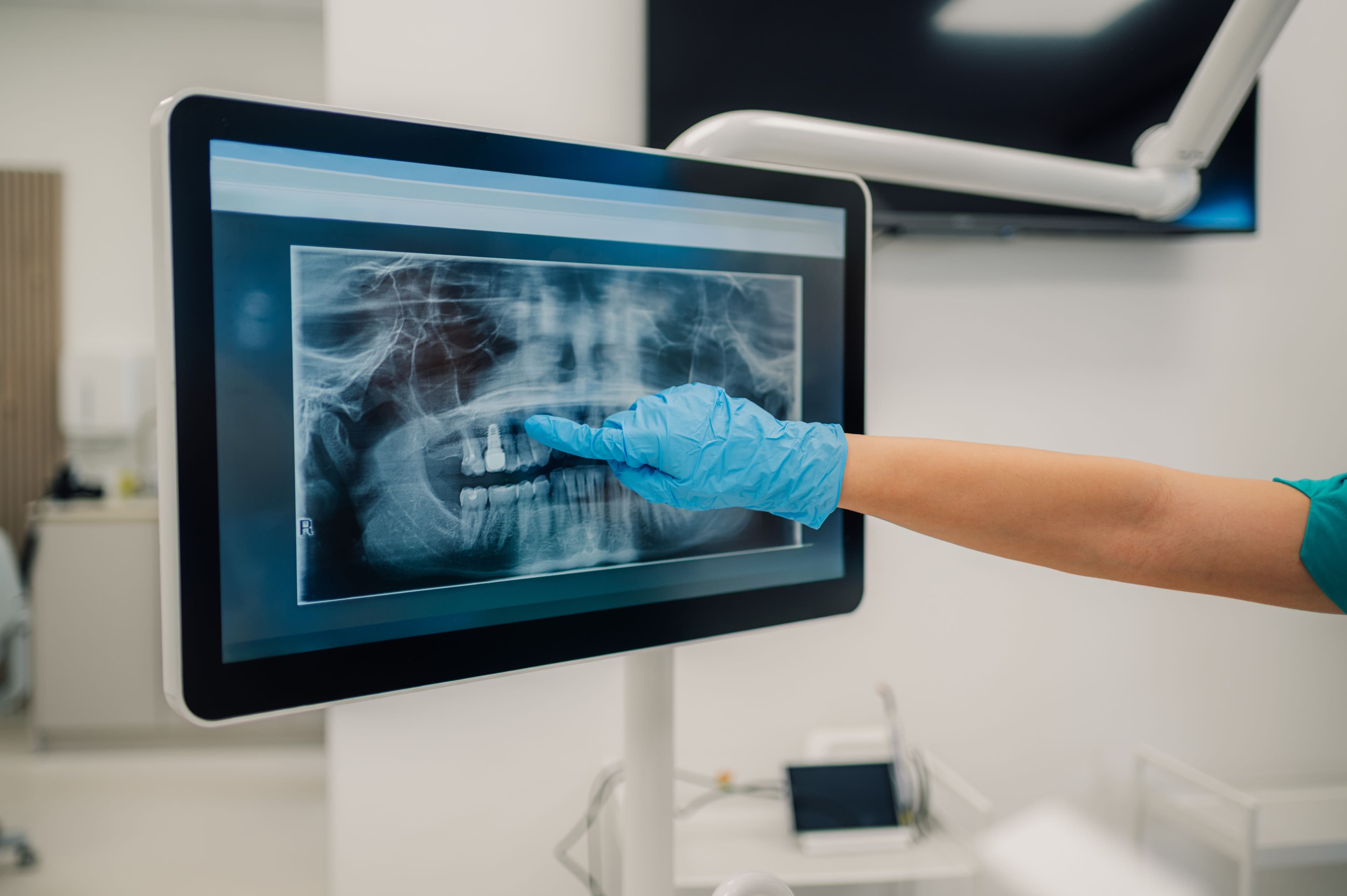 2D Dental Imaging